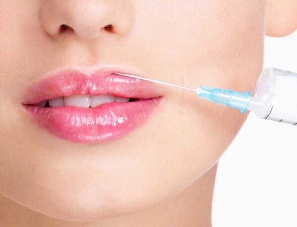 Eight Amazing Benefits of Lip Reduction Surgery